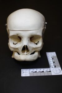 Human skull with no teeth
