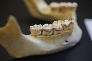 Close-up of the jaw and lower teeth, showing wear on the molars.