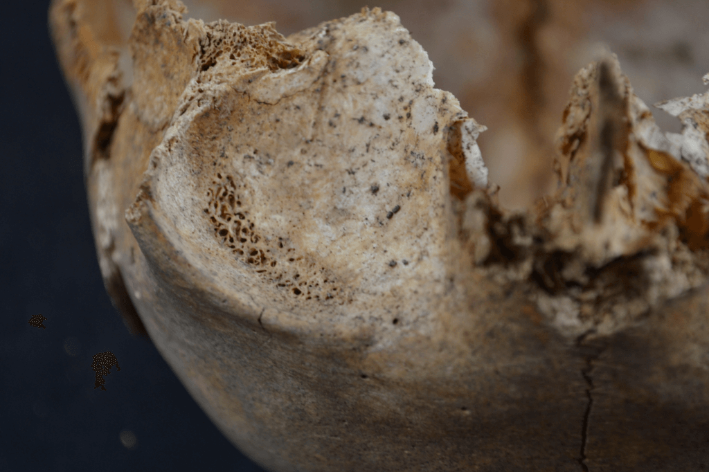 Close-up of the eye socket showing small holes in bone.